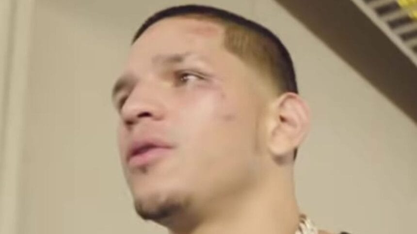 Is Edgar Berlanga Dodging Real Contenders for a Big Payday?